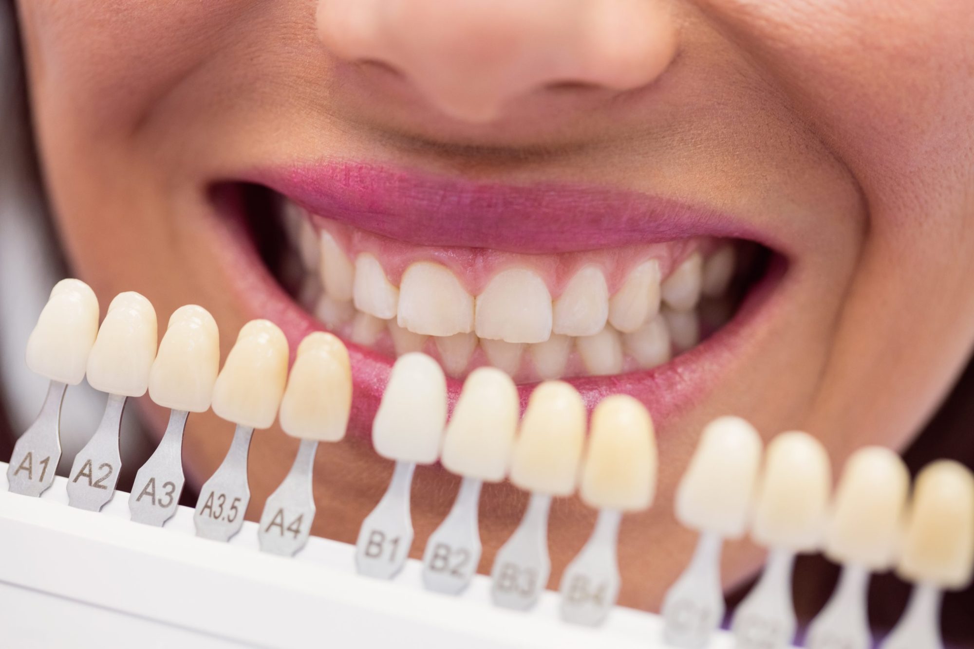 Tratamientos en clínica dental